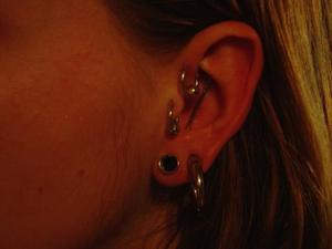 Cartilage