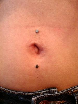 implant microdermal