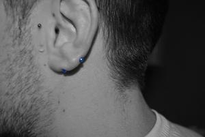 lobe transversal
