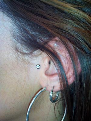 micro dermal