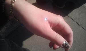 micro dermal main