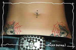 Micro dermal nombril