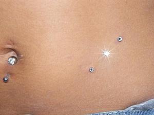 micro dermal nombril