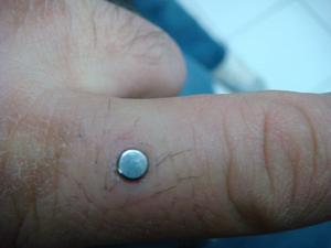 micro dermal pouce