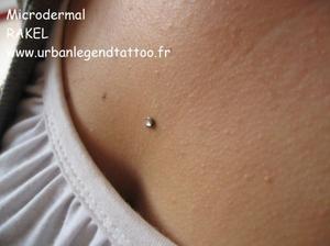 Microdermal