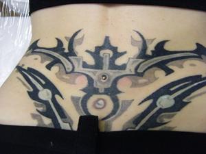 microdermal vissé