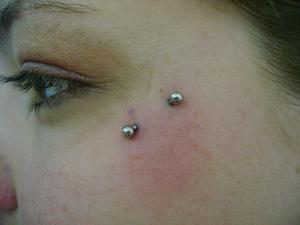 oeil de chat