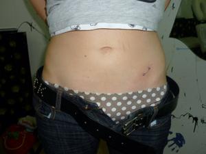 piercing surface
