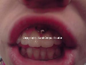 Smiley, piercing sur la gencive