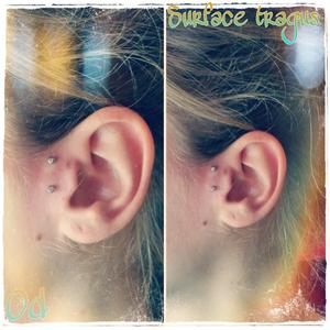 Surface tragus