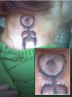 Symbole scarification