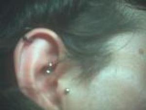 tragus et cartillage