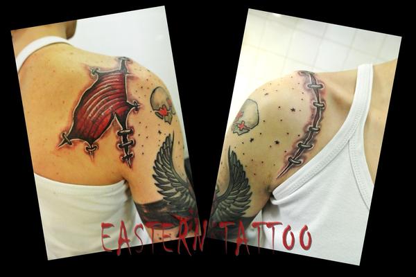 Cicatrice