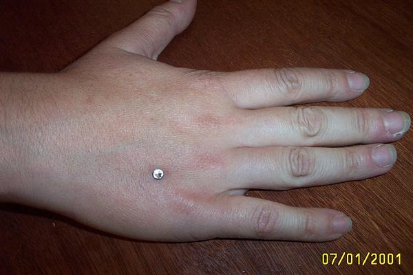 dermal