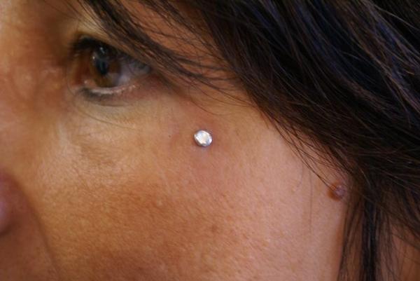 dermal oeil