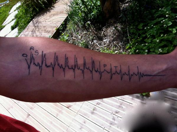 Electrocardiogramme