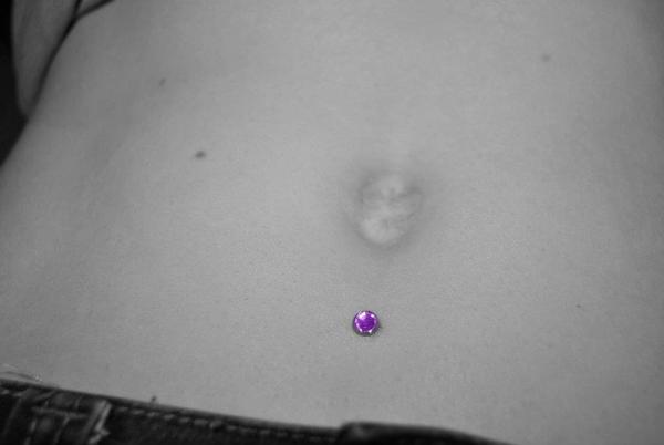 implant microdermal