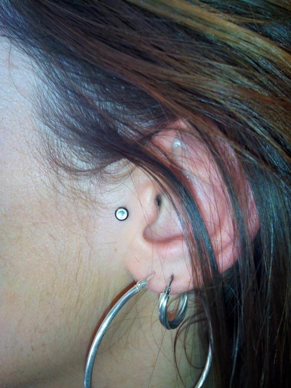 micro dermal