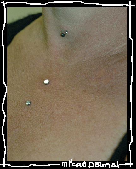 Photo de micro dermal sternum et micro piercing, implant, dermal réalisé par Arxe