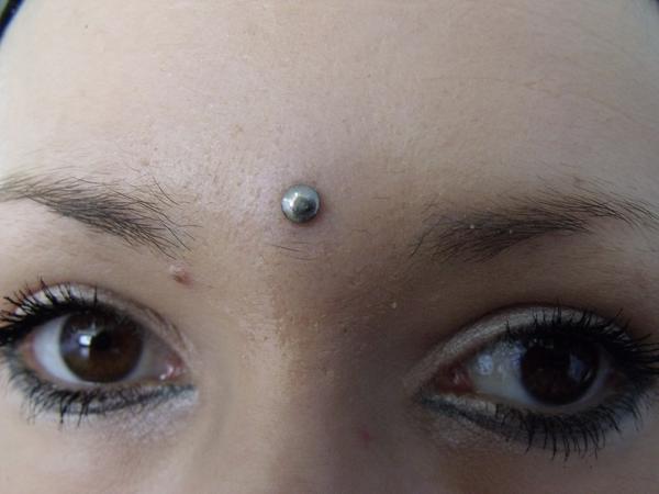 microdermal front
