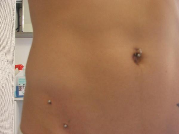 Photo de piercing à l'aine, piercing, superficiel réalisé par A m'aime la peau