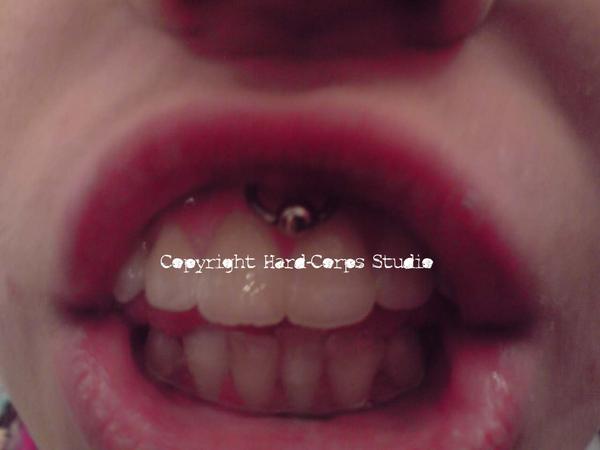 Smiley, piercing sur la gencive